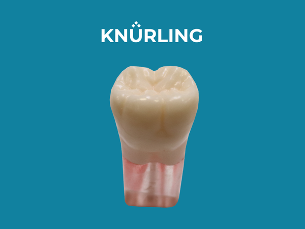 Kilgore S12-700 – Clear Root with Red Painted Canal