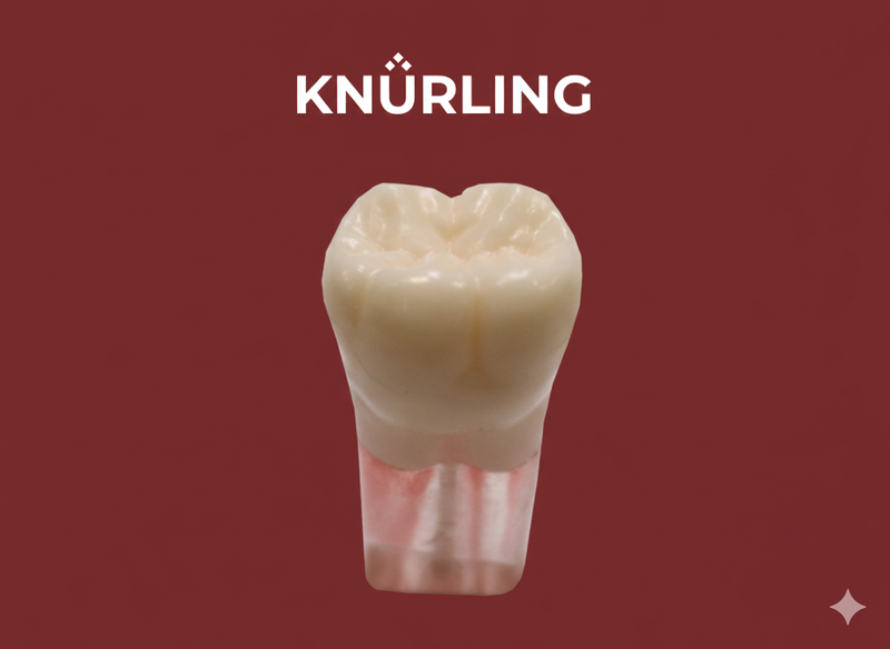 Kilgore S12-700 – Clear Root with Red Painted Canal