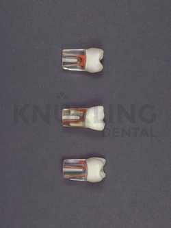 S12-200 – Clear Root Endodontic Teeth